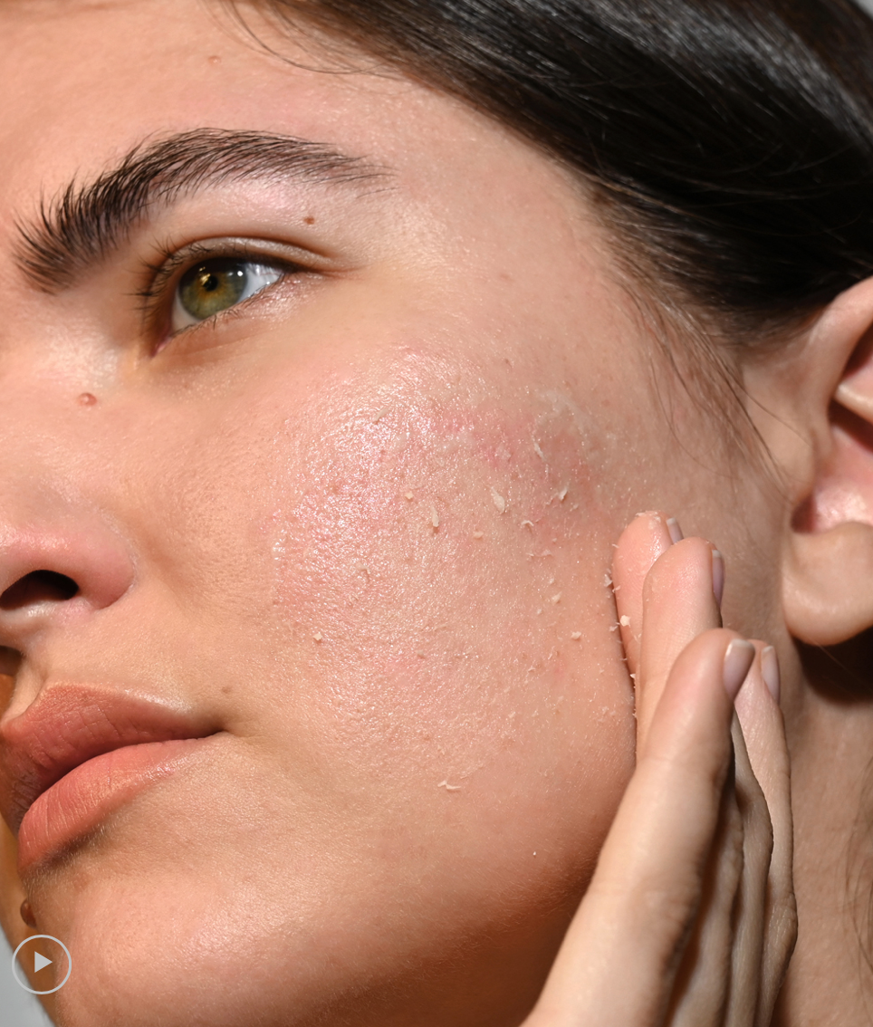 Triple Effect Peeling